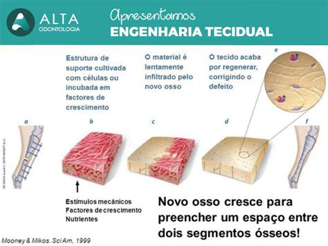 OSTEALLOY: Uma Revolução na Engenharia Óssea de Alta Performance para Implantes Duradouros!